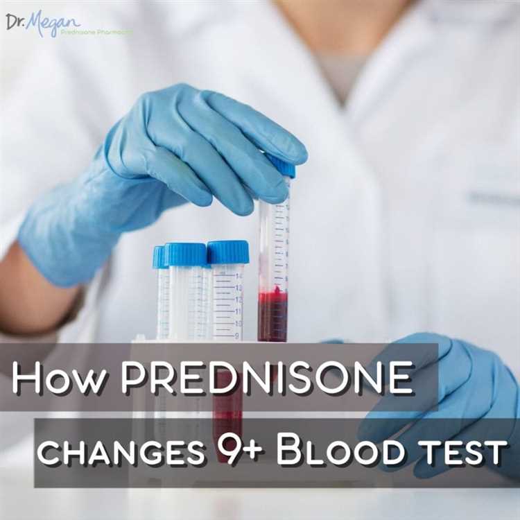Prednisone Side Effects: What You Need to Know